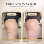 Lymphatic Suction Massager